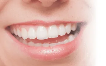 白く整った前歯の笑顔